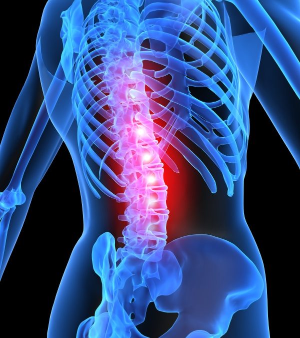 Spinal Subluxation